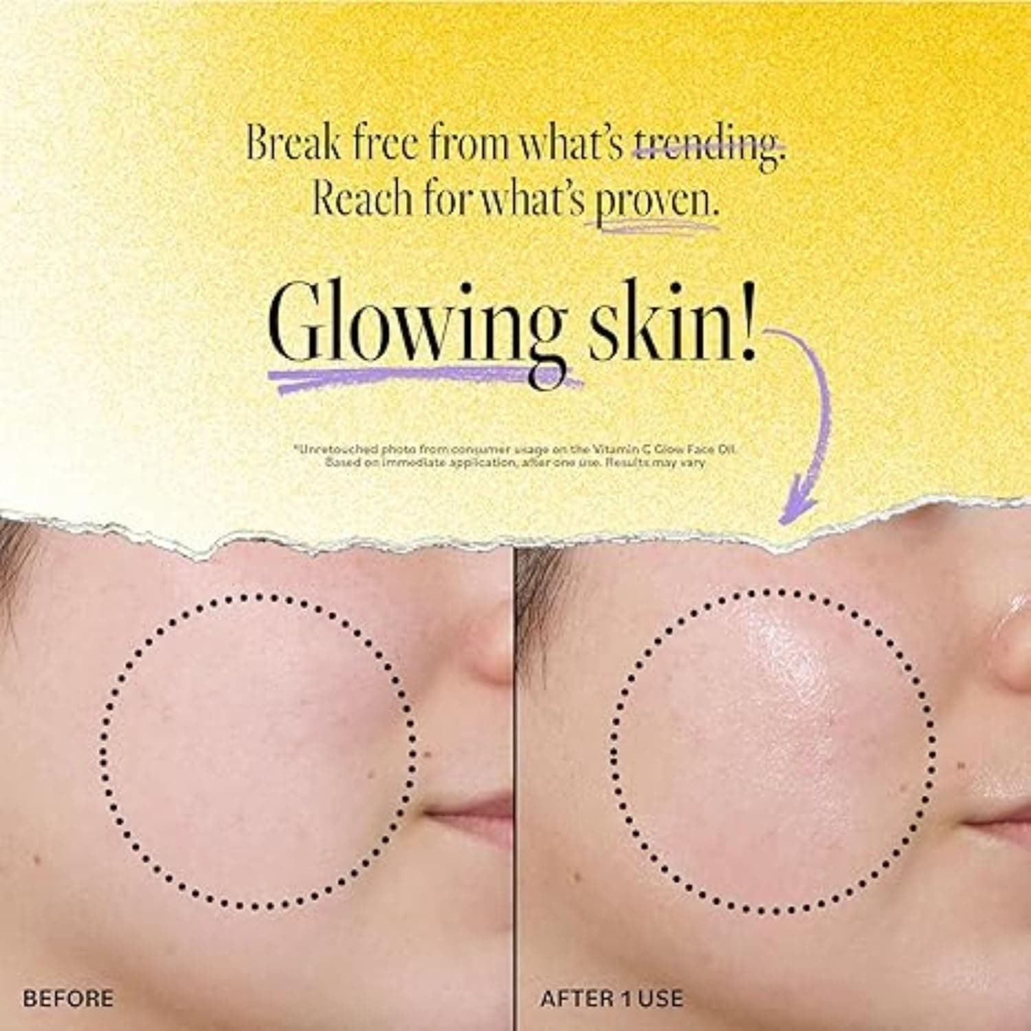 VeetGold Vitamin C Body Corrector Oil - alternate